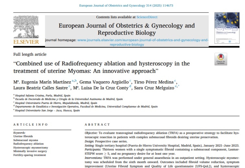 Combined use of Radiofrequency ablation and hysteroscopy in the treatment of uterine Myomas: An innovative approach” | María Eugenia Marín, Obstetricia y Ginecología
